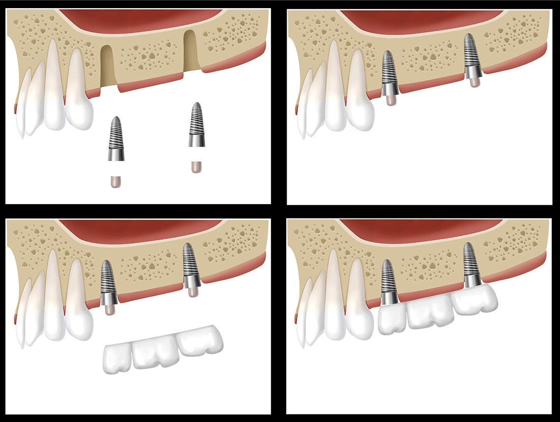 Empress Walk Dental Toronto