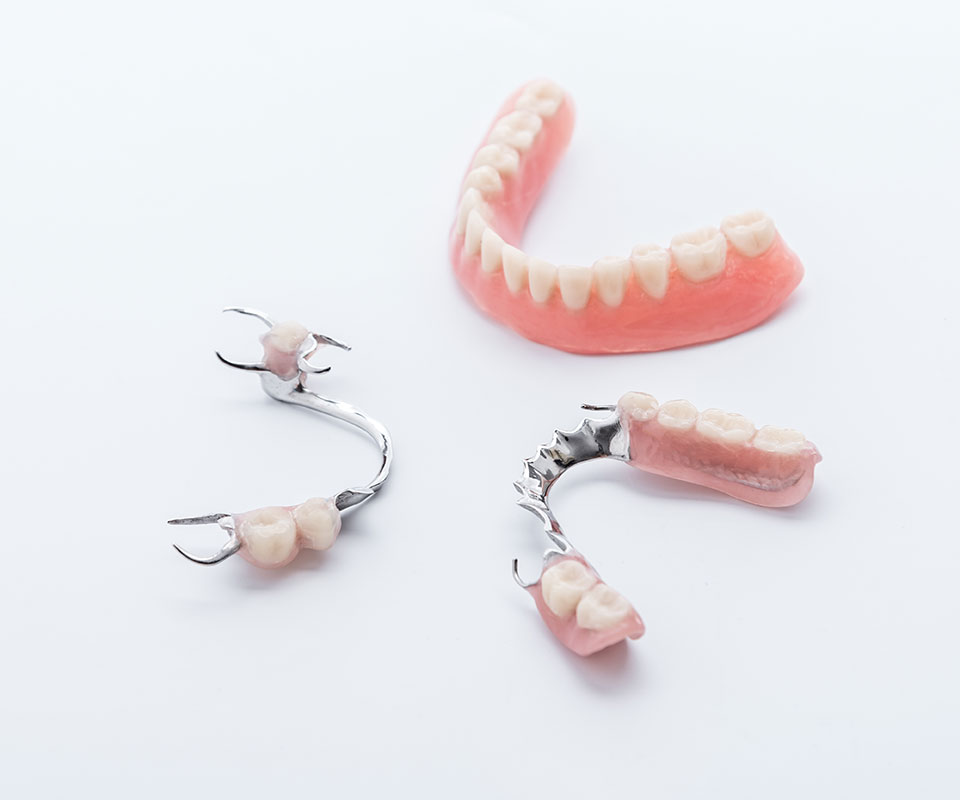 Partial Dentures in North York